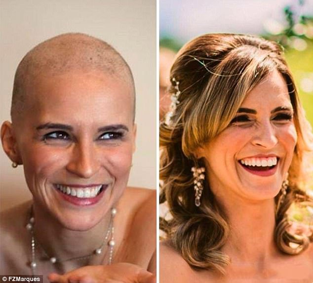 Οταν γίνονται θαύματα -Νίκησαν τον καρκίνο και μοιράζονται φωτογραφίες πριν και μετά [εικόνες] | iefimerida.gr 7