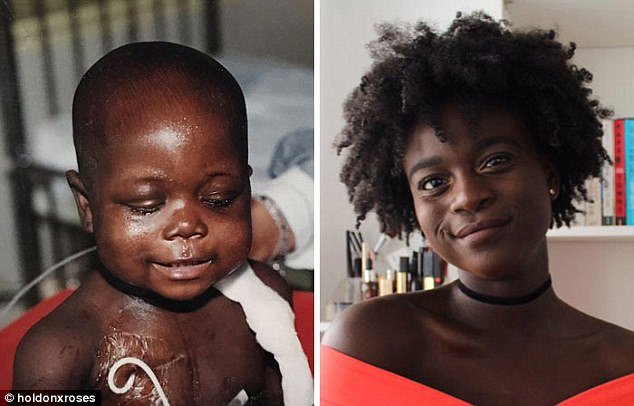 Οταν γίνονται θαύματα -Νίκησαν τον καρκίνο και μοιράζονται φωτογραφίες πριν και μετά [εικόνες] | iefimerida.gr 8