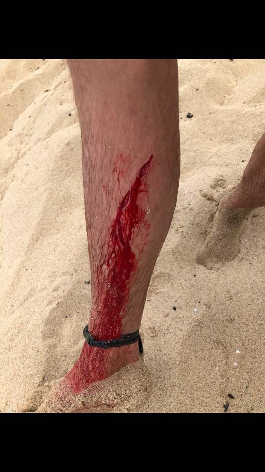 Αυτό θα πει τύχη: Του επιτέθηκε καρχαρίας, αρκούδα και τον δάγκωσε φίδι μέσα σε 4 χρόνια [εικόνες] | iefimerida.gr 1