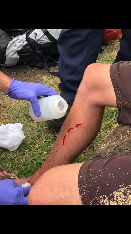 Αυτό θα πει τύχη: Του επιτέθηκε καρχαρίας, αρκούδα και τον δάγκωσε φίδι μέσα σε 4 χρόνια [εικόνες] | iefimerida.gr 0