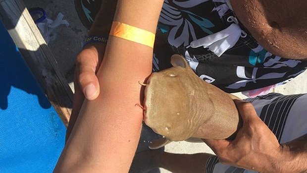 Στο νοσοκομείο 23χρονη με καρχαρία καρφωμένο στο χέρι της [εικόνες] | iefimerida.gr 1