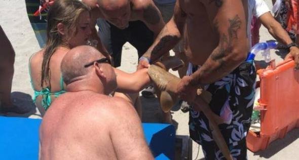 Στο νοσοκομείο 23χρονη με καρχαρία καρφωμένο στο χέρι της [εικόνες] | iefimerida.gr 2