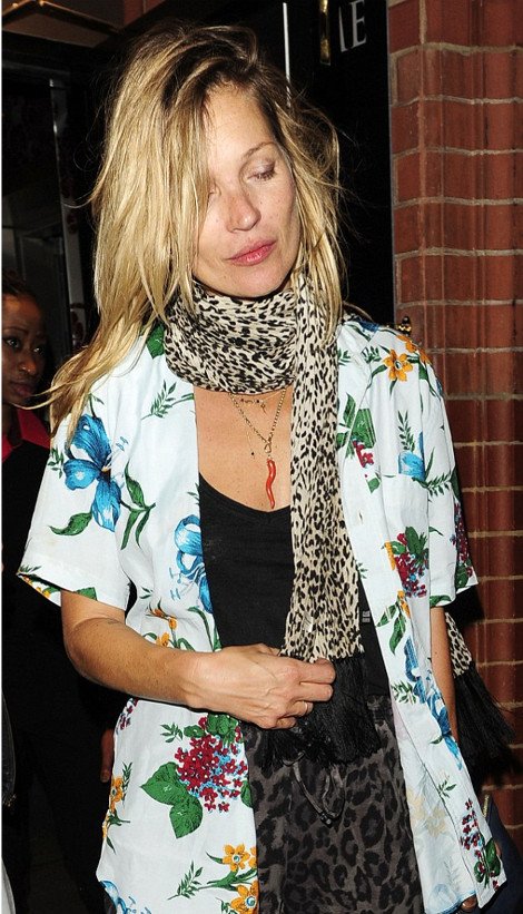 Η Κέιτ Μος μάλλον «λιώμα» –Αχτένιστη, άβαφη, με χαβανέζικο πουκάμισο και λεοπάρ παντελόνι [εικόνες] | iefimerida.gr 0