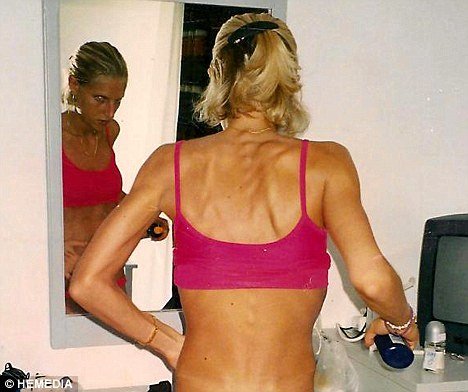 «Ή θα πάρεις 20 κιλά, ή ο γάμος ακυρώνεται» [εικόνες] | iefimerida.gr 2