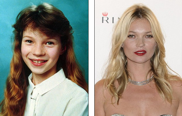 Τα ασχημόπαπα που έγιναν διάσημοι κύκνοι [εικόνες] | iefimerida.gr 7