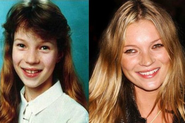 Πώς ήταν τα σούπερ μόντελ στην εφηβεία -Από άχαρα κορίτσια σέξι θηλυκά [εικόνες] | iefimerida.gr 8