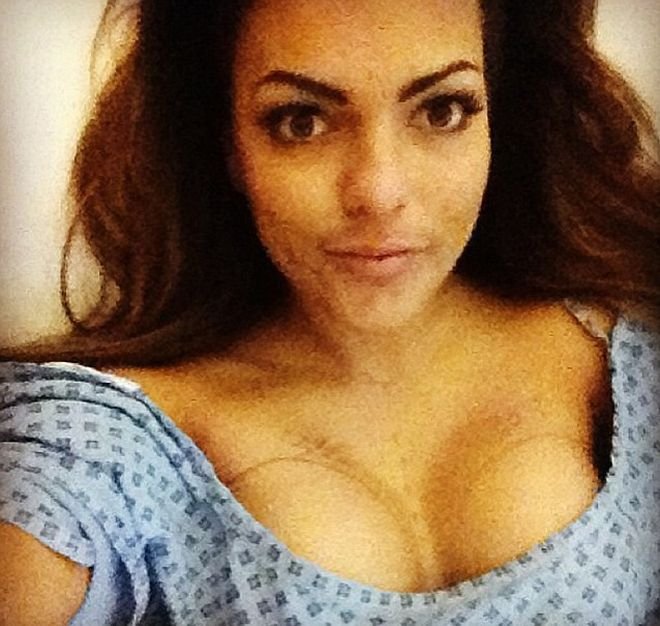 Ελληνίδα φοιτήτρια μιλά στην Mirror για την προσθετική στήθους που της άλλαξε την καριέρα [εικόνες] | iefimerida.gr 2