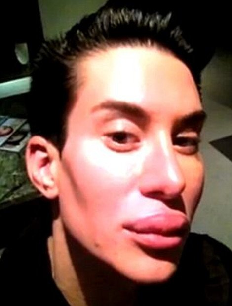 Ανδρας έκανε 100 πλαστικές επεμβάσεις για να μοιάσει σε κούκλα [εικόνες] | iefimerida.gr 2