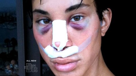 Ανδρας έκανε 100 πλαστικές επεμβάσεις για να μοιάσει σε κούκλα [εικόνες] | iefimerida.gr 3