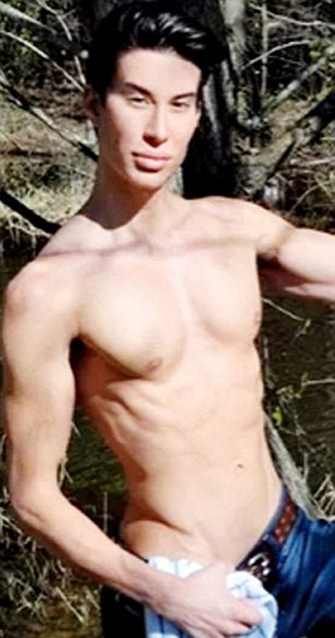 Ανδρας έκανε 100 πλαστικές επεμβάσεις για να μοιάσει σε κούκλα [εικόνες] | iefimerida.gr 4