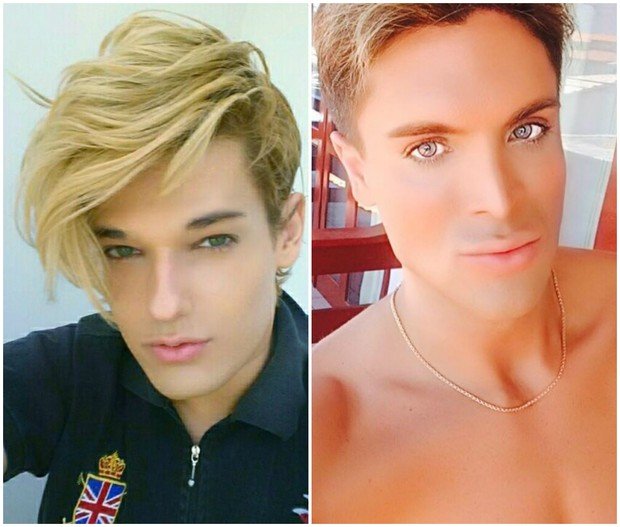 Μετά τη γυναίκα Barbie ήρθε ο ζωντανός Ken: Η τρομακτική μεταμόρφωση 27χρονου [εικόνες] | iefimerida.gr 5