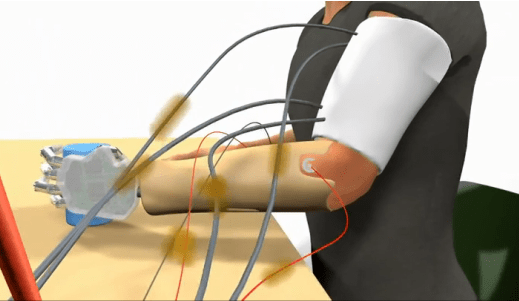 Το πρώτο προσθετικό χέρι που αισθάνεται παρουσίασε διεθνής ομάδα ερευνητών [εικόνες] | iefimerida.gr 4