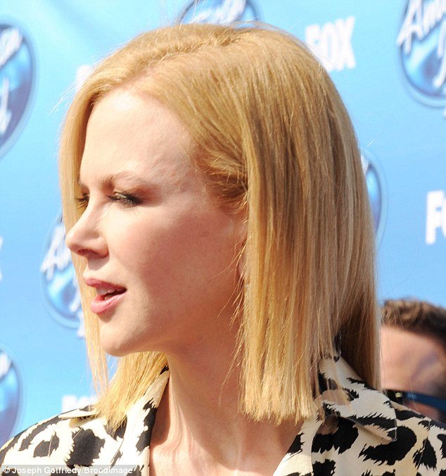 Ατσαλάκωτη: Πρησμένο και ανέκφραστο το πρόσωπο της Κίντμαν [εικόνες] | iefimerida.gr 1