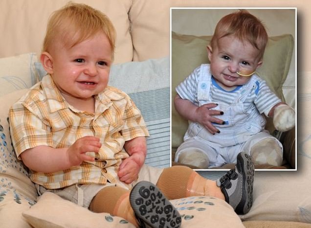 Του έκαναν δώρο νέα πόδια για τα πρώτα του γενέθλια [εικόνες] | iefimerida.gr 0