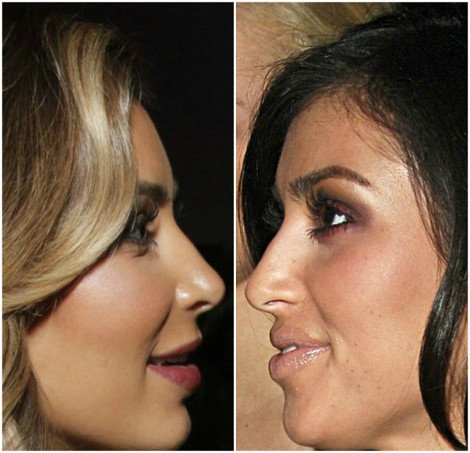 Εχει κάνει η Κιμ Καρντάσιαν πλαστική στη μύτη; Τι δείχνουν οι φωτογραφίες [εικόνες] | iefimerida.gr 1