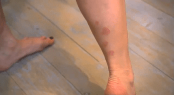 Η άγνωστη αρρώστια της Κιμ Καρντάσιαν [εικόνες] | iefimerida.gr 8