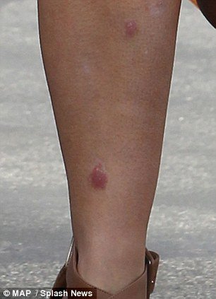 Η άγνωστη αρρώστια της Κιμ Καρντάσιαν [εικόνες] | iefimerida.gr 6