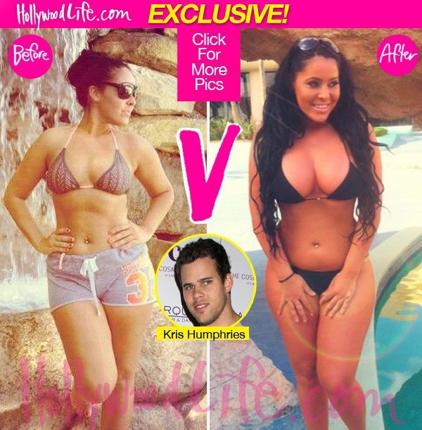 Αλβανίδα θα δώσει 30.000 δολάρια σε πλαστικές για να μοιάσει στην Κιμ Καρντάσιαν [εικόνες] | iefimerida.gr 1