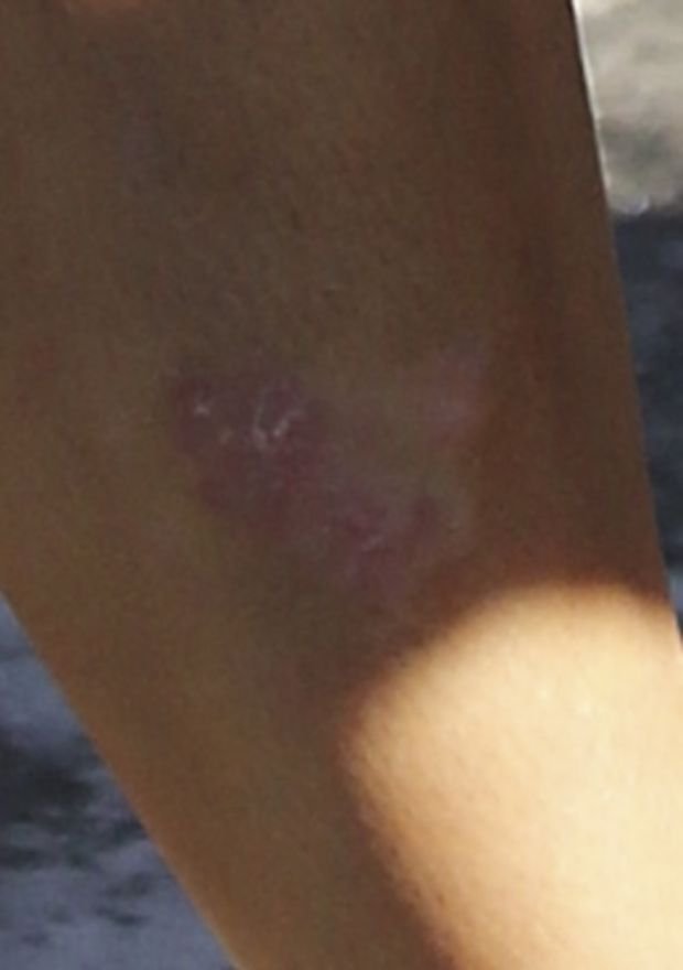 Η άγνωστη αρρώστια της Κιμ Καρντάσιαν [εικόνες] | iefimerida.gr 4