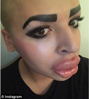 Νεαρός κάνει πλαστικές για να μοιάσει στην Καρντάσιαν -Το αποτέλεσμα τρομάζει [εικόνες] | iefimerida.gr 1