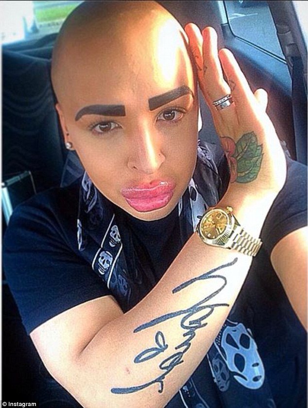 Νεαρός κάνει πλαστικές για να μοιάσει στην Καρντάσιαν -Το αποτέλεσμα τρομάζει [εικόνες] | iefimerida.gr 4