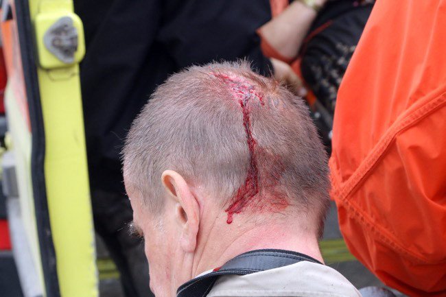 Κεραυνός «χτύπησε» τουρίστες στην Κνωσό -19 τραυματίες, μία γυναίκα υπέστη ανακοπή [εικόνες] | iefimerida.gr 4