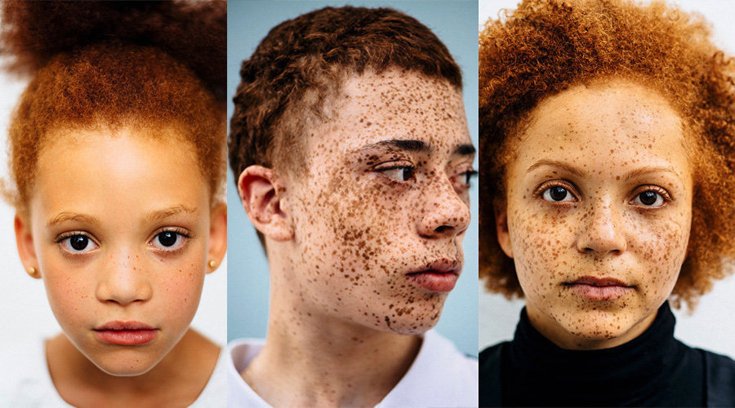 Ωδή στους κοκκινομάλληδες  – Η σπάνια ομορφιά τους μέσα από τα κλικ μιας φωτογράφου [εικόνες]  | iefimerida.gr 6