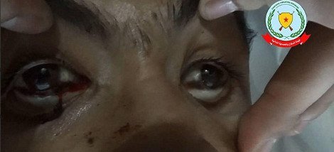 Το BBC λέει ότι οι τζιχαντιστές χρησιμοποιούν χημικά όπλα στο Κομπάνι [εικόνες] | iefimerida.gr 2