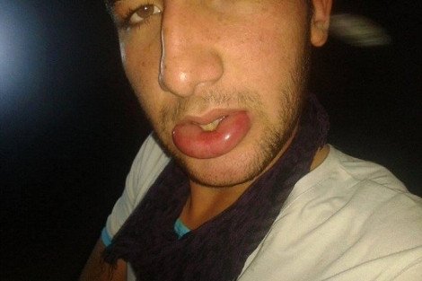 Το BBC λέει ότι οι τζιχαντιστές χρησιμοποιούν χημικά όπλα στο Κομπάνι [εικόνες] | iefimerida.gr 0