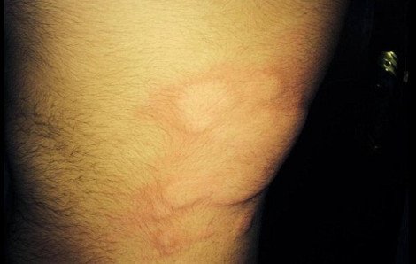 Το BBC λέει ότι οι τζιχαντιστές χρησιμοποιούν χημικά όπλα στο Κομπάνι [εικόνες] | iefimerida.gr 1