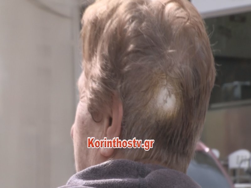 Ενέδρα στην εθνική Κορίνθου-Εξαμιλίων -Ρομά χτύπησαν ηλικιωμένη με πέτρα για να την ληστέψουν [εικόνες & βίντεο] | iefimerida.gr 1