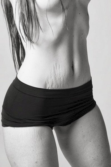 Τα κορμιά των εγκύων και των νέων μαμάδων όπως πραγματικά είναι: Ραγάδες, παραπανίσια κιλά... [εικόνες] | iefimerida.gr 0