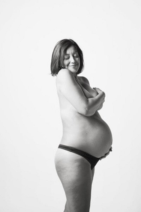 Τα κορμιά των εγκύων και των νέων μαμάδων όπως πραγματικά είναι: Ραγάδες, παραπανίσια κιλά... [εικόνες] | iefimerida.gr 5