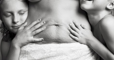 Τα κορμιά των εγκύων και των νέων μαμάδων όπως πραγματικά είναι: Ραγάδες, παραπανίσια κιλά... [εικόνες] | iefimerida.gr 6