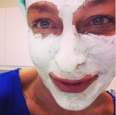 Ο Κωστέτσος βρέθηκε με γάζες στο πρόσωπο [εικόνες] | iefimerida.gr 0