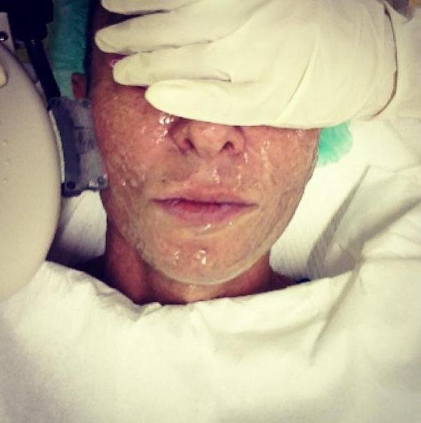 Ο Κωστέτσος βρέθηκε με γάζες στο πρόσωπο [εικόνες] | iefimerida.gr 1