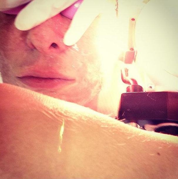 Ο Κωστέτσος βρέθηκε με γάζες στο πρόσωπο [εικόνες] | iefimerida.gr 2