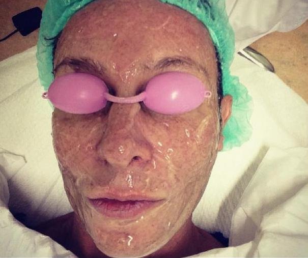 Ο Κωστέτσος βρέθηκε με γάζες στο πρόσωπο [εικόνες] | iefimerida.gr 3