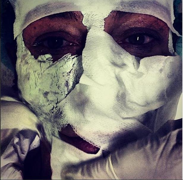 Ο Κωστέτσος βρέθηκε με γάζες στο πρόσωπο [εικόνες] | iefimerida.gr 4