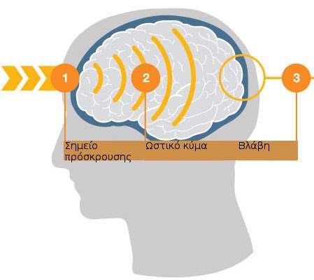 Τι συνέβη με τον Μίκαελ Σουμάχερ -Πως ο εγκέφαλος επηρεάστηκε από το χτύπημα [γράφημα] | iefimerida.gr 0