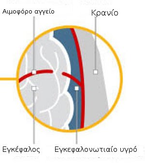 Τι συνέβη με τον Μίκαελ Σουμάχερ -Πως ο εγκέφαλος επηρεάστηκε από το χτύπημα [γράφημα] | iefimerida.gr 1
