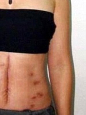 Αιματοχυσία δίχως τέλος στο Μεξικό - Βασάνισαν και σκότωσαν πρώην δήμαρχο [εικόνες] | iefimerida.gr 0