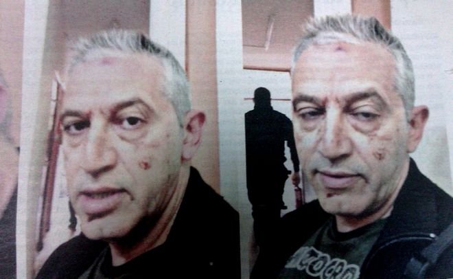 Επιβάτης καταγγέλλει ξυλοδαρμό από ελεγκτή του Μετρό: «Κρατούσε χαρτοκόπτη και μου έλεγε θα σε σκοτώσω» [εικόνα] | iefimerida.gr 0