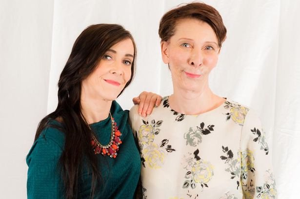 Η 18χρονη που μοιάζει με πενηντάρα -Στα 16 έκανε το πρώτο της λίφτινγκ [εικόνες]  | iefimerida.gr 9