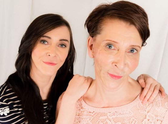 Η 18χρονη που μοιάζει με πενηντάρα -Στα 16 έκανε το πρώτο της λίφτινγκ [εικόνες]  | iefimerida.gr 8