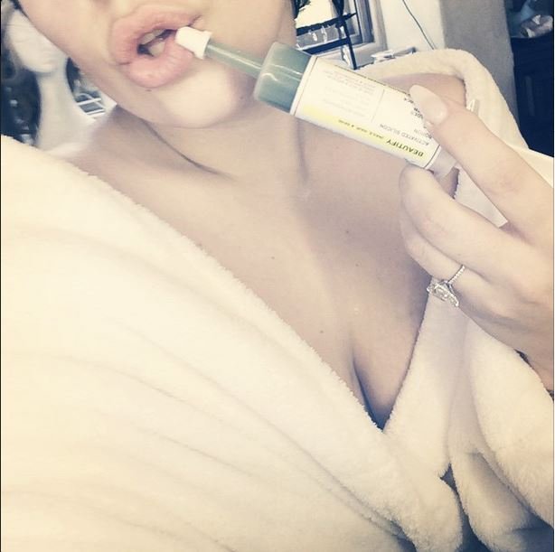 H Lady Gaga κάνει μόνη της ενέσεις στα χείλη [εικόνες] | iefimerida.gr 3
