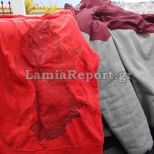 Λαμία: Ετσι γλίτωσαν ο 18χρονος και η 13χρονη από την επίθεση μανιακού με μαχαίρι [βίντεο]  | iefimerida.gr 0