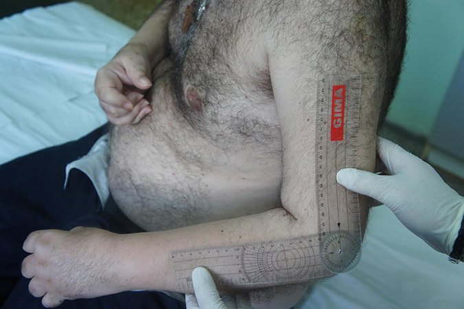 Κινδυνεύει η ζωή του Λαυρεντιάδη, λένε οι δικηγόροι του -Σε αχρηστία τα άνω άκρα του [εικόνες] | iefimerida.gr 2