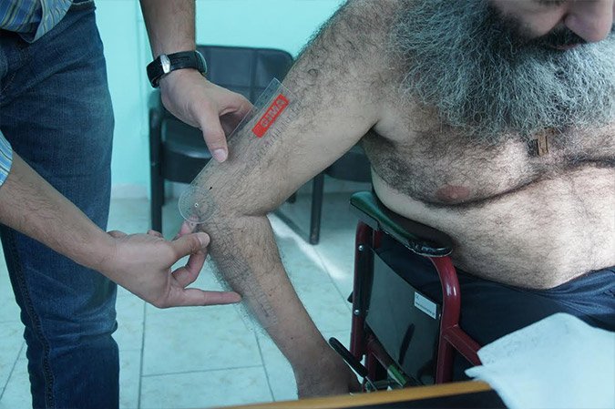 Κινδυνεύει η ζωή του Λαυρεντιάδη, λένε οι δικηγόροι του -Σε αχρηστία τα άνω άκρα του [εικόνες] | iefimerida.gr 4