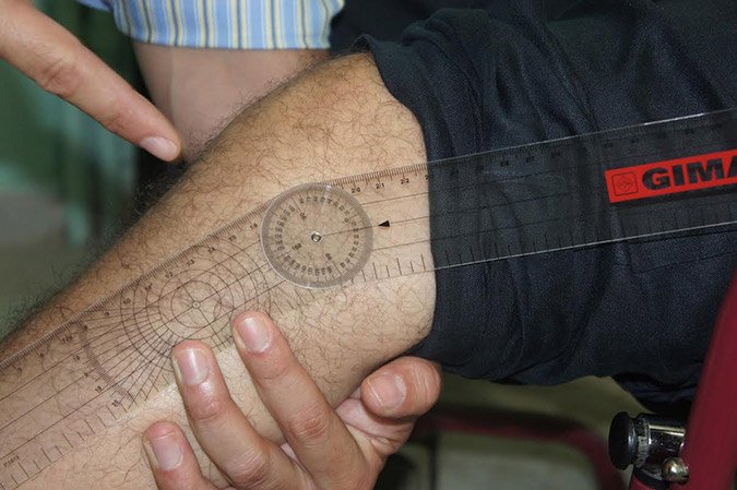 Κινδυνεύει η ζωή του Λαυρεντιάδη, λένε οι δικηγόροι του -Σε αχρηστία τα άνω άκρα του [εικόνες] | iefimerida.gr 1